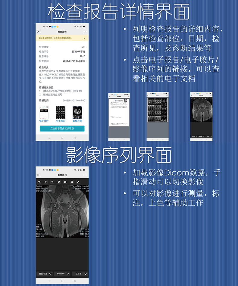 醫院放射透視檢測報告電子膠片檢查報告云管理系統軟件開發APP小程序定制 醫院放射透視檢測報告電子膠片檢查報告云管理系統軟件開發APP小程序定制